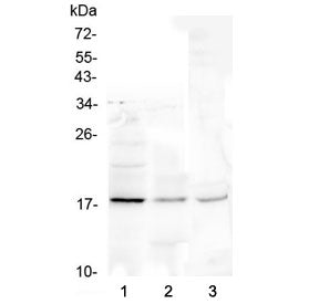 Western blot testing of 1) human Jurkat, 2) rat liver and 3) mouse liver lysate with Ribonuclease 3 