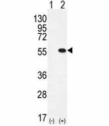 Western blot analysis of PRMT2 antibody and 293 cell lysate either nontransfected (Lane 1) or transi