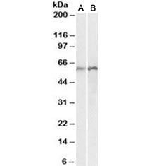 Western blot testing of human [A] and rat [B] lung lysates with Calreticulin antibody at 0.01ug/ml. 
