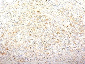 FN1 Antibody / Fibronectin