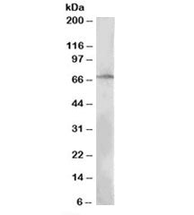 Western blot testing of MOLT4 lysate with LNK antibody at 0.3ug/ml. Predicted molecular weight: ~63 