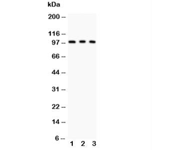 Western blot testing of CD146 antibody and Lane 1: A375; 2: HeLa; 3: HEPG2. The glycoprotein is rout