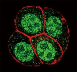 Confocal immunofluorescent analysis of phospho-SMAD2 antibody with HeLa cells followed by Alexa Fluo