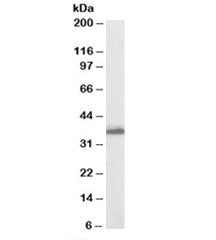 AKR1C3 Antibody