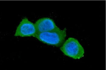 Immunofluorescent staining of FFPE human MCF7 cells with Caspase 3 antibody (green) and DAPI nuclear