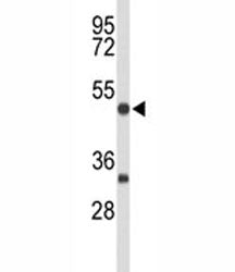 MEF2A Antibody