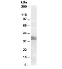 Western blot testing of Jurkat nuclear lysate with FRG1 antibody at 2ug/ml. Predicted/observed molec