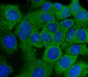 SSH3BP1 Antibody