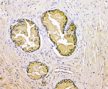 PSA Antibody / Prostate Specific Antigen / KLK3
