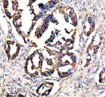 Immunohistochemical staining of STX4 using anti-STX4 antibody. STX4 was detected in a paraffin-embed