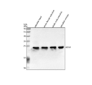 Western blot analysis of Sod2 protein using Zebrafish Sod2 antibody and 1) zebrafish head, 2) whole 