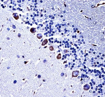 IHC testing of FFPE mouse cerebellum tissue with CKI-gamma 3 antibody. HIER: steam section in pH6 citrate buffer for 20 min and allow to cool prior to staining.