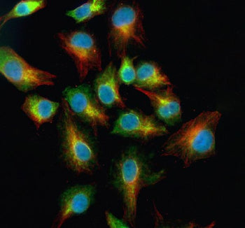 Immunofluorescent staining of NPY2R using anti-NPY2R antibody (green) and anti-Beta Tubulin antibody