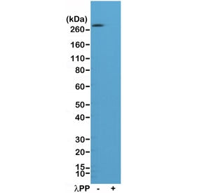 Western blot of A431 cell lysate, untreated (-) or treated (+) with Lambda Protein Phosphatase (Î»PP