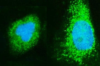 Immunofluorescent staining of FFPE human A431 cells with ADP-ribosylation factor 6 antibody (green) 