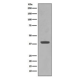 Maltose Binding Protein Antibody / malE / MBP tag