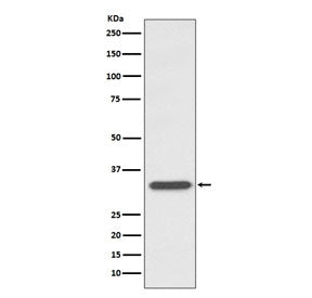 Western blot testing of human Ramos cell lysate with CD74 antibody. Expected molecular weight: 33-43