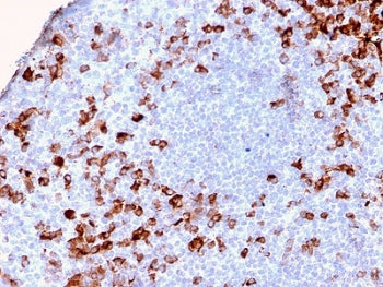 IHC testing of FFPE human tonsil tissue with recombinant Kappa antibody (clone KLC2886R). Required H