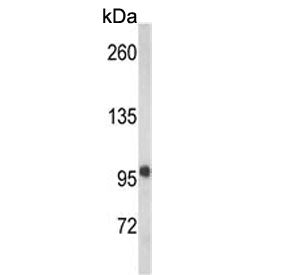 Western blot testing of mouse brain tissue lysate with VPS53 antibody. Predicted molecular weight ~9