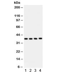 PINX1 Antibody