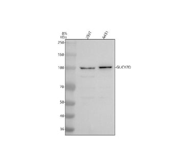 Western blot analysis of GUCY2D using anti-GUCY2D antibody. Electrophoresis was performed on a 8% SD
