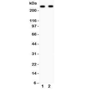 Western blot testing of CaV1.3 antibody and Lane 1: rat brain; 2: mouse brain lysate. Predicted mole