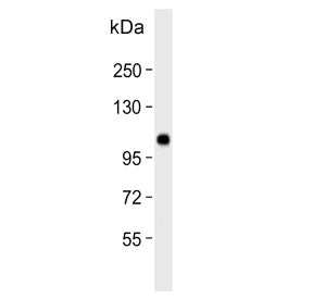 Western blot testing of human SK-BR-3 cell lysate with Espin antibody. Predicted molecular weight ~9