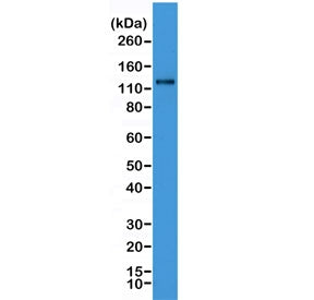 Western blot testing of human HeLa cell lysate with recombinant N-Cadherin antibody. Predicted molec