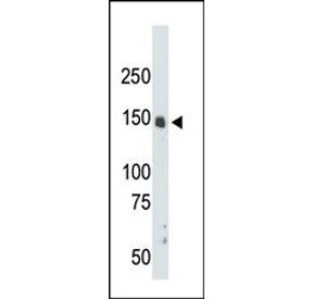 Western blot testing of mouse liver tissue lysate with CrkRS antibody. Predicted molecular weight ~164 kDa.
