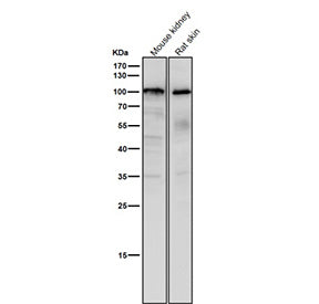 All lanes use the USP5 antibody at 1:1K dilution for 1 hour at room temperature. Predicted molecular