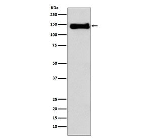 Western blot testing of human U937 cell lysate with ITGB1 antibody. Expected molecular weight: 88~15