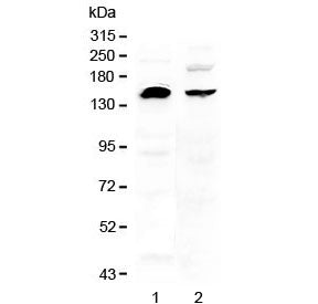 Western blot testing of human 1) U-87 MG and 2) MDA-MB-453 cell lysate with NEDD4 antibody at 0.5ug/