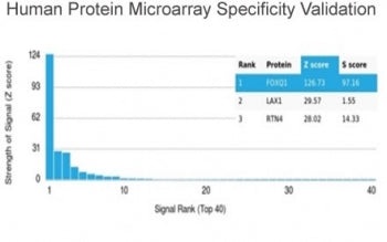 Analysis of HuProt(TM) microarray containing more than 19,000 full-length human proteins using FOXQ1