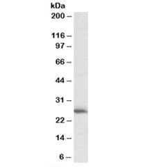 Western blot testing of human heart lysate with CLPP antibody at 1ug/ml. Predicted molecular weight: