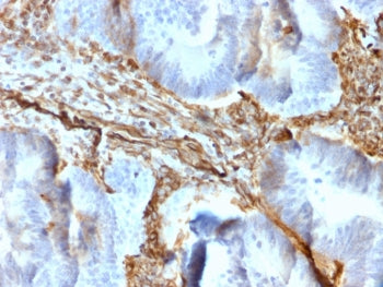 Vimentin Antibody