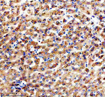 IHC staining of FFPE human liver tissue with Apolipoprotein H antibody, HRP-secondary and DAB substr