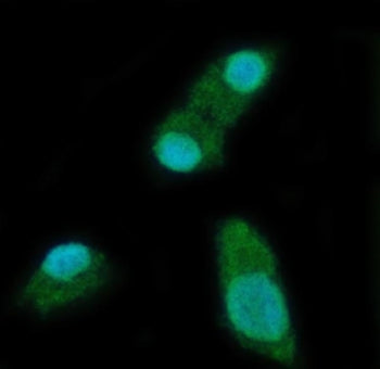 YTH domain-containing protein 2 Antibody / YTHDC2