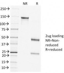 Clathrin Heavy Chain Antibody