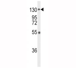 Western blot analysis of FGFR1 antibody and mouse liver tissue lysate. Predicted molecular weight: 7