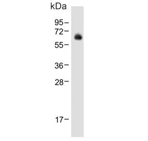 Western blot testing of human liver tissue lysate with UDP-glucuronosyltransferase 2B15 antibody. Pr