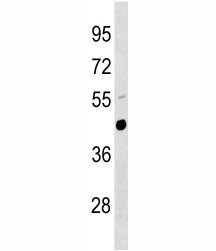 Urokinase Antibody