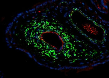 Immunofluorescent staining of FFPE human placental tissue with ACTA2 antibody (green), CD31 antibody