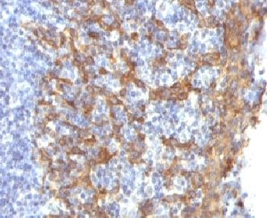 IHC testing of FFPE human prostate with Keratin 14 antibody (clone CTKN14-1). Staining of formalin-f