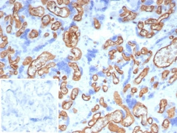IHC staining of FFPE human placental tissue with CD34 antibody (clone CD34/7721) at 2ug/ml. Inset: P