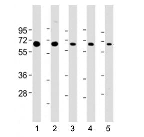 PSMD3 Antibody (C-Terminal Region)