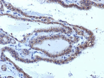 Thyroid Stimulating Hormone Receptor / TSHR Antibody (alpha chain)