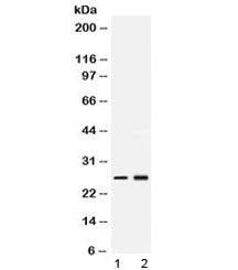 PSMA2 Antibody / Proteasome 20S alpha 2