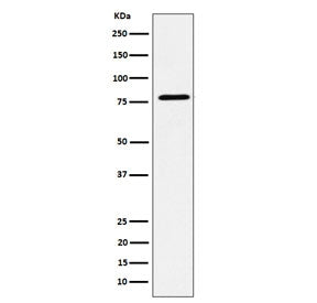 Western blot testing of human MCF7 cell lysate with EXOC3 antibody. Predicted molecular weight ~85 k