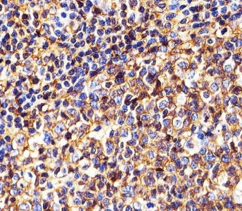 IHC testing of FFPE human tonsil tissue with HLA-B antibody. HIER: steam section in pH6 citrate buff