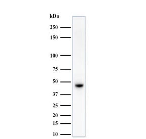 Basic Cytokeratin Antibody (HMW / Type II)